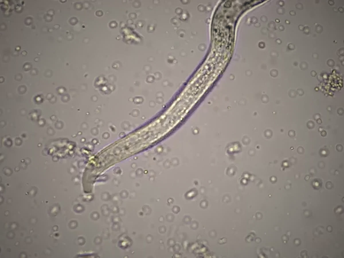 A nematode and surrounding microorganisms seen through a microscope.